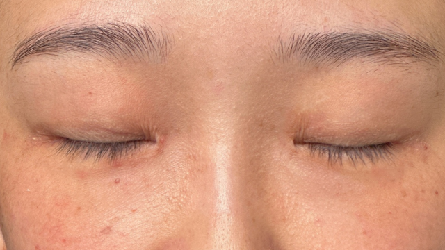 Preoperative Condition Part 1