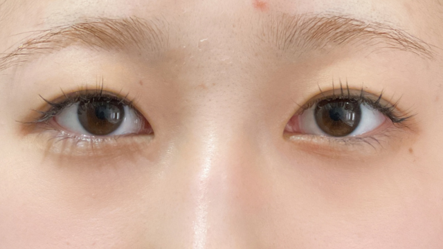 Preoperative Condition Part 1