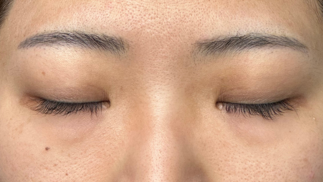 Preoperative Condition Part 1