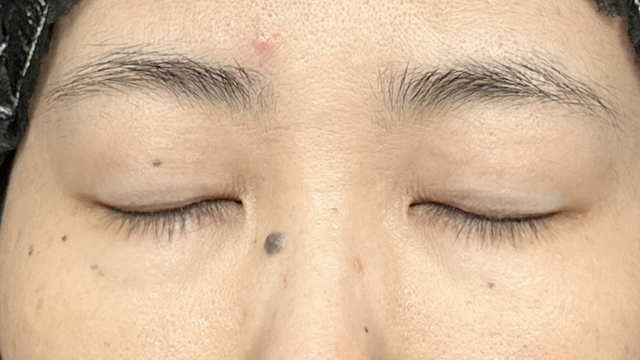 Preoperative Condition Part 1