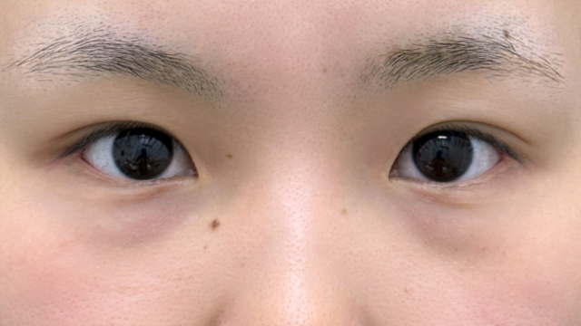 Preoperative Condition Part 1