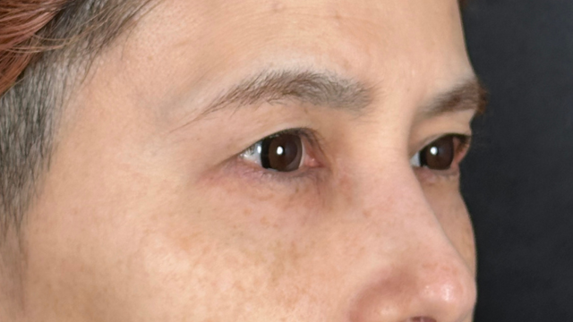 手术前的状态 其一