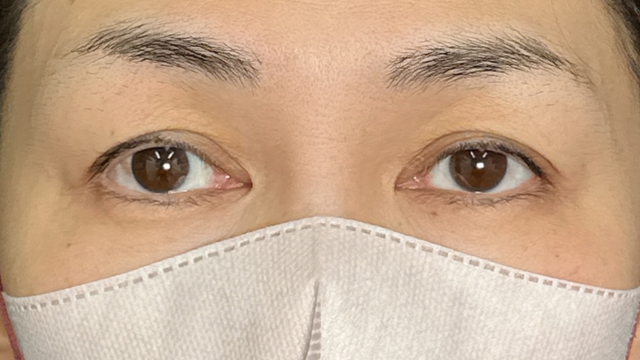 Preoperative Condition Part 1