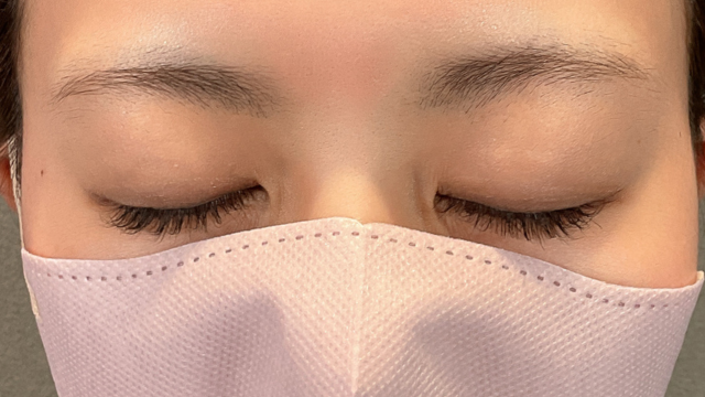 手术前的状态 其一