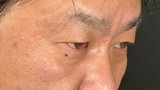 Preoperative Condition Part 1