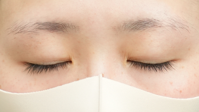 手术前的状态 其一