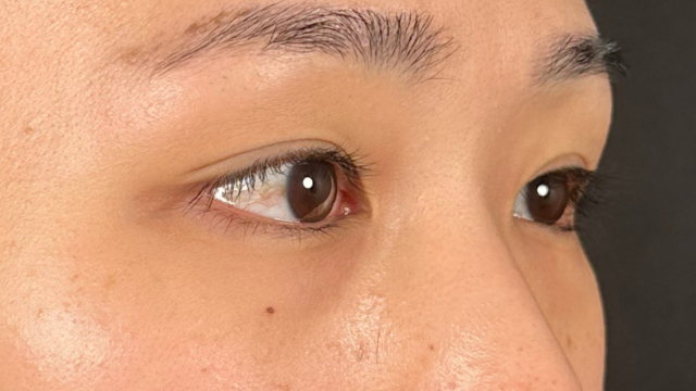 手术前的状态 其一