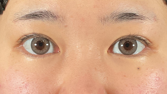 手术前的状态 其一