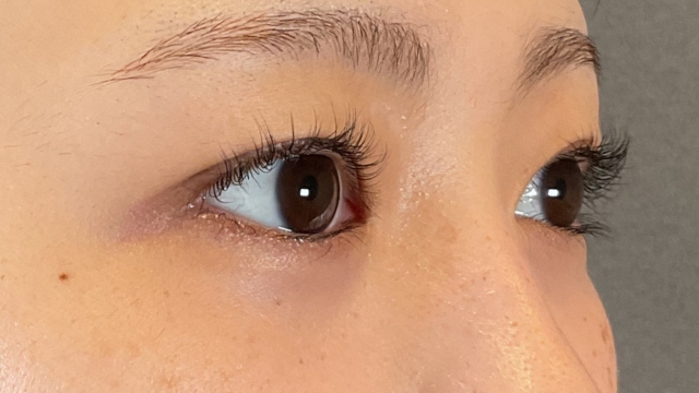 手术前的状态 其一