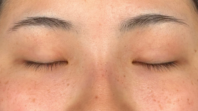 手术前的状态 其一