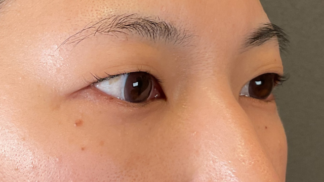 手术前的状态 其一