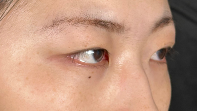 手术前的状态 其一