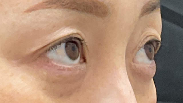 Preoperative Condition Part 1