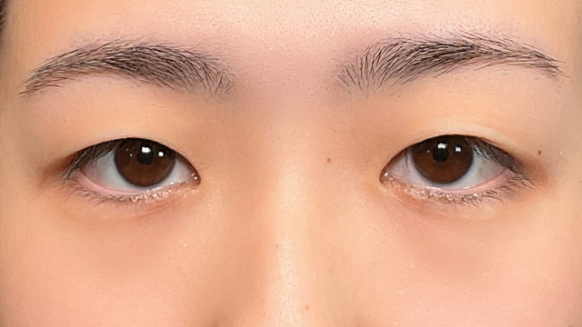 手术前的状态 其一