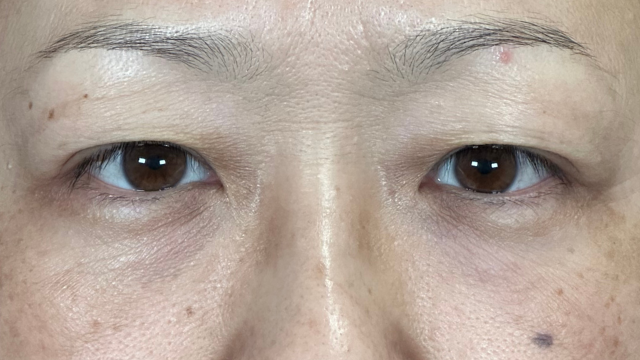 Preoperative Condition Part 1