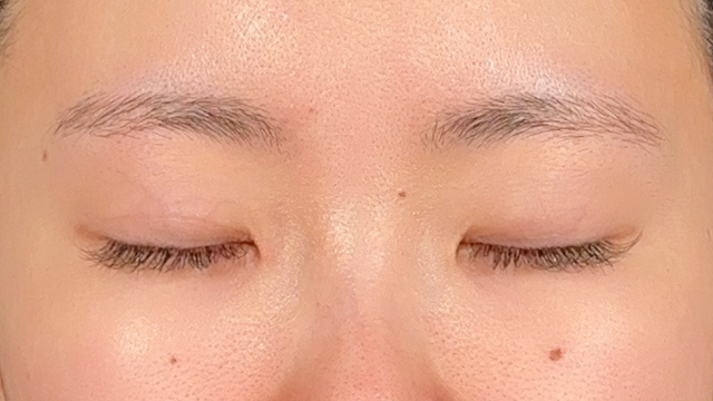 Preoperative Condition Part 1