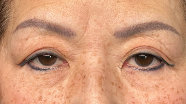 Preoperative Condition Part 1