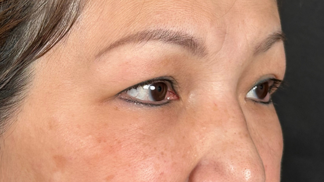 Preoperative Condition Part 1