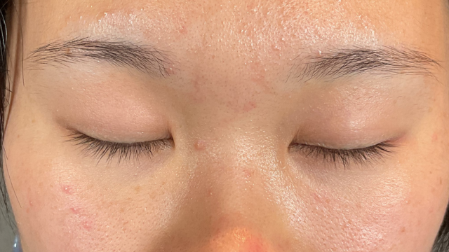 手术前的状态 其一