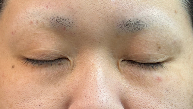 Preoperative Condition Part 1