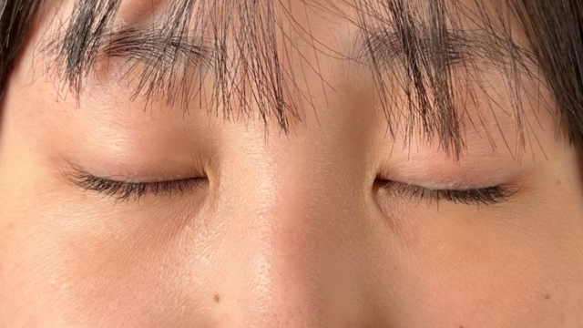 手术前的状态 其一