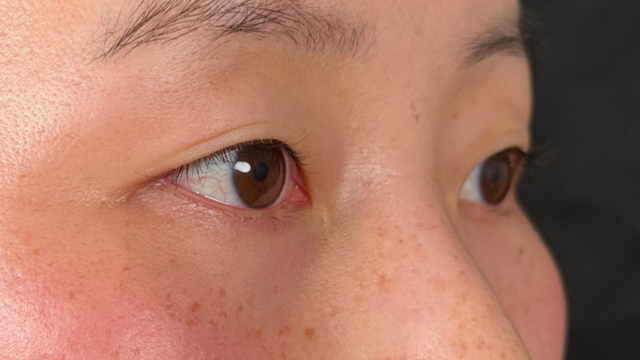 手术前的状态 其一