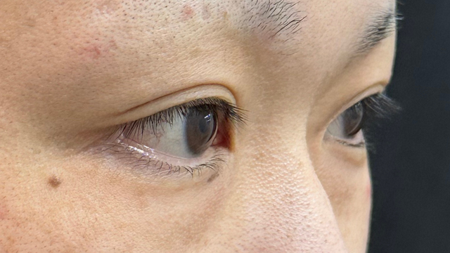 Preoperative Condition Part 1