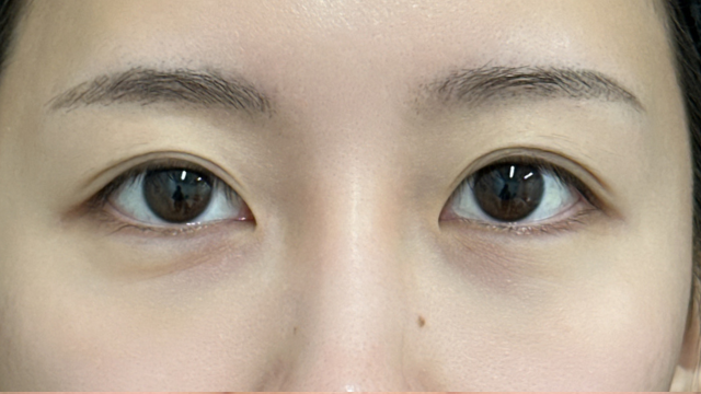 手术前的状态 其一