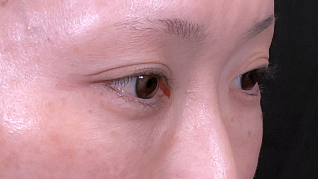 Preoperative Condition Part 1