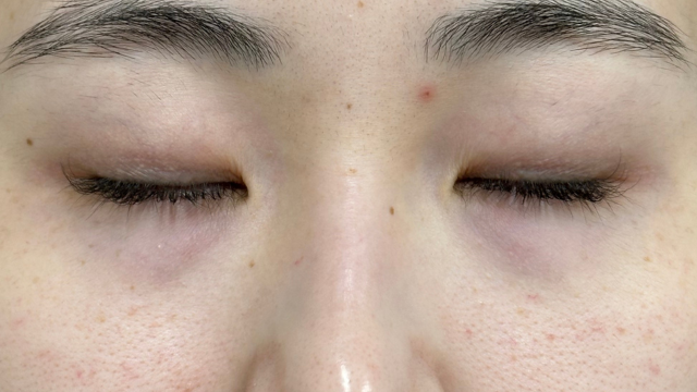 手术前的状态 其一