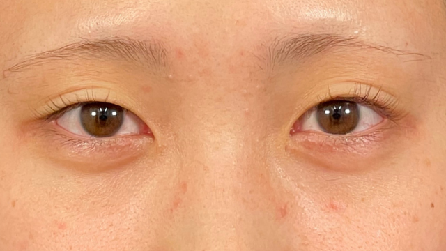 Preoperative Condition Part 1