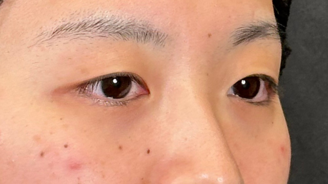 Preoperative Condition Part 1