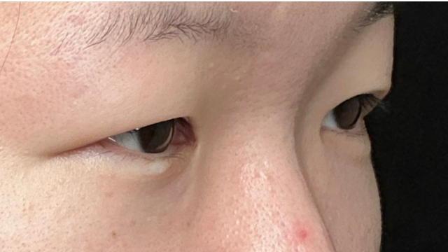 手术前的状态 其一