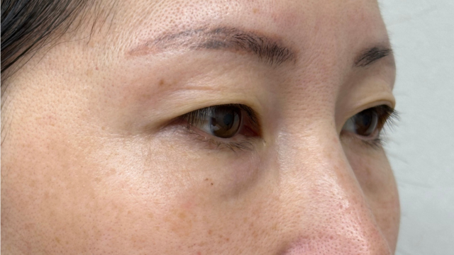 手术前的状态 其一