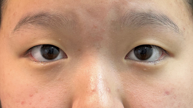 手术前的状态 其一