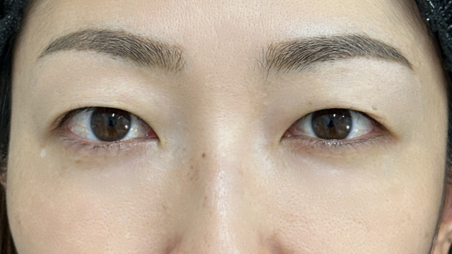 手术前的状态 其一