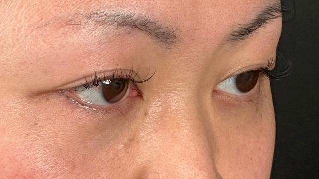 Preoperative Condition Part 1