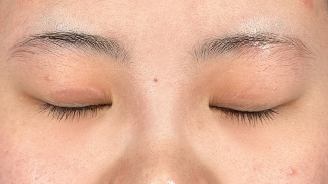 Preoperative Condition Part 1