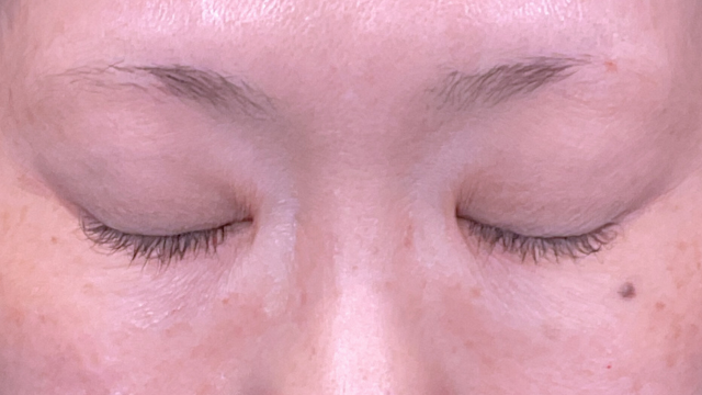 Preoperative Condition Part 1