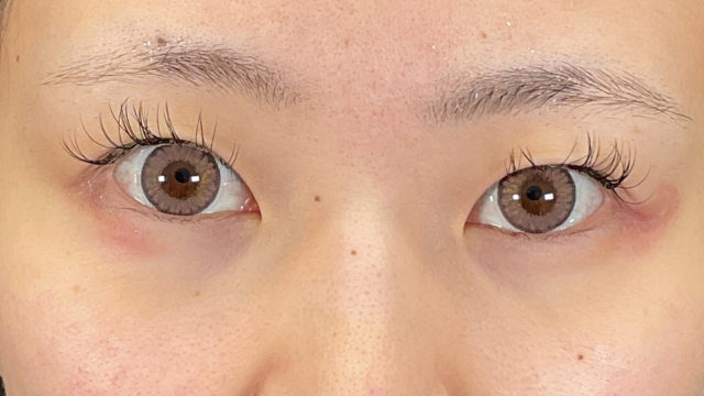 手术前的状态 其一