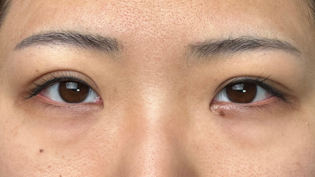 Preoperative Condition Part 1