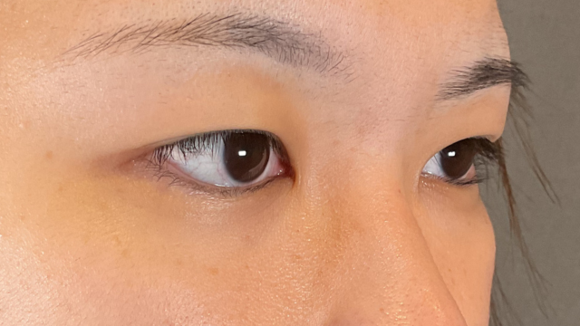 手术前的状态 其一