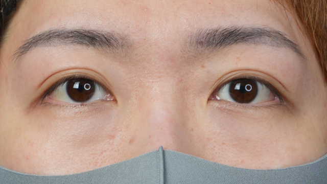 手术前的状态 其一