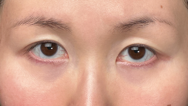 Preoperative Condition Part 1