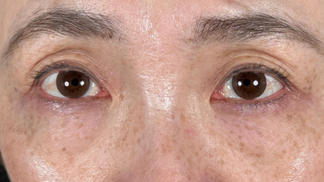 手术前的状态 其一