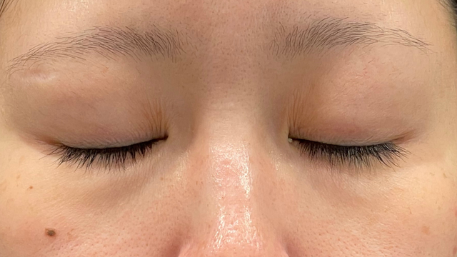 Preoperative Condition Part 1