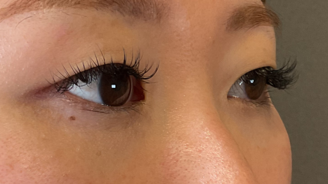 手术前的状态 其一