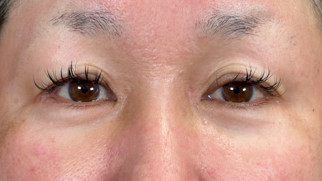 Preoperative Condition Part 1