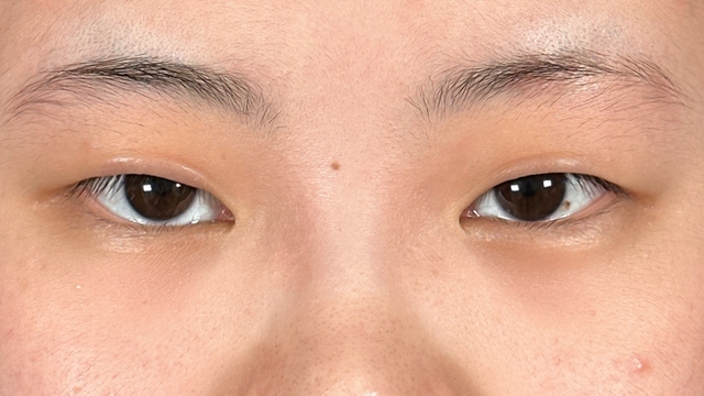 Preoperative Condition Part 1