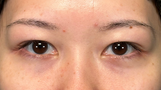 Preoperative Condition Part 1